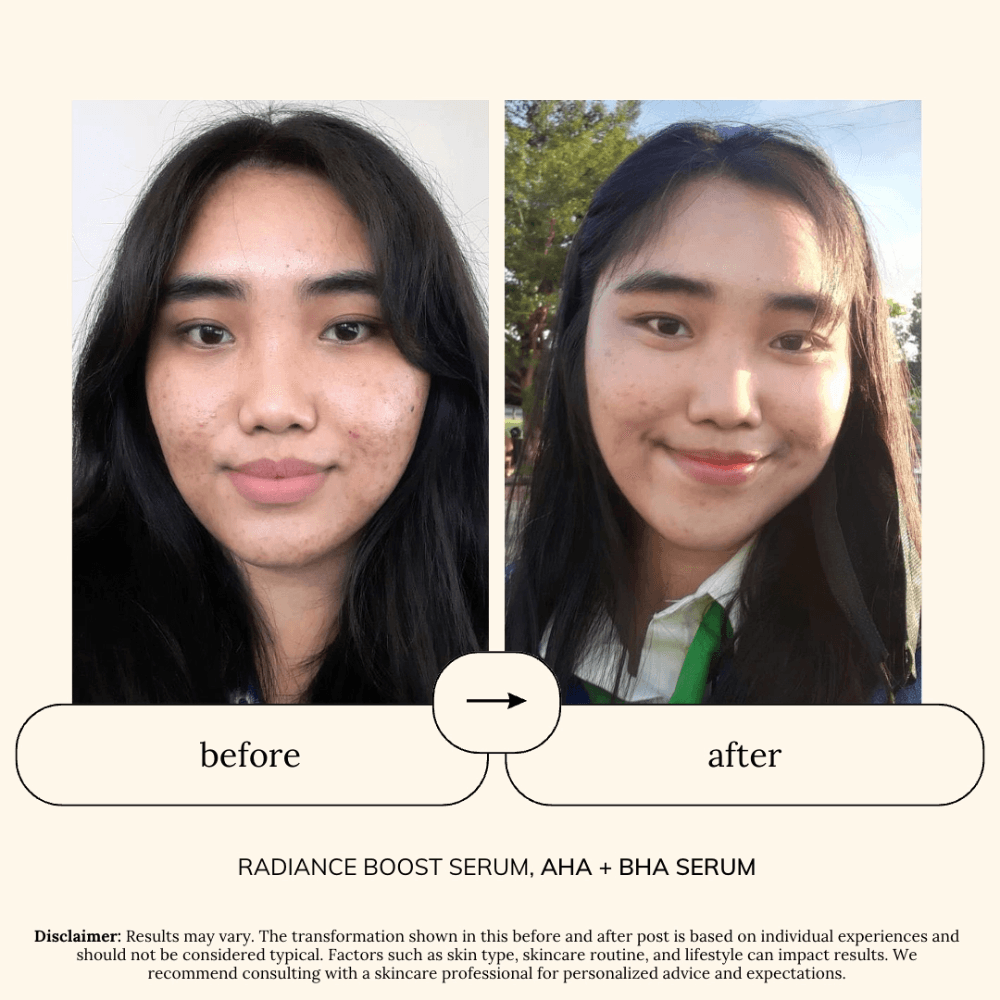 Soul Apothecary AHA + BHA Serum | 6% AHA + 2% BHA Exfoliating Serum thumbnail 4