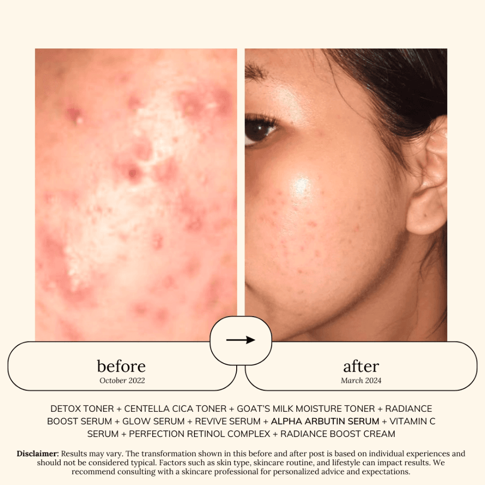 Soul Apothecary Alpha Arbutin PLUS Serum | 5% Niacinamide + 2% Alpha Arbutin + Tranexamic Acid thumbnail 4