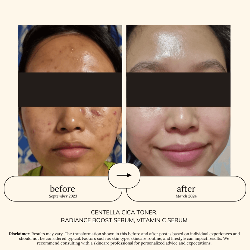 Soul Apothecary Centella CICA Toner | 35% Centella Asiatica Barrier Repair Toner thumbnail 5