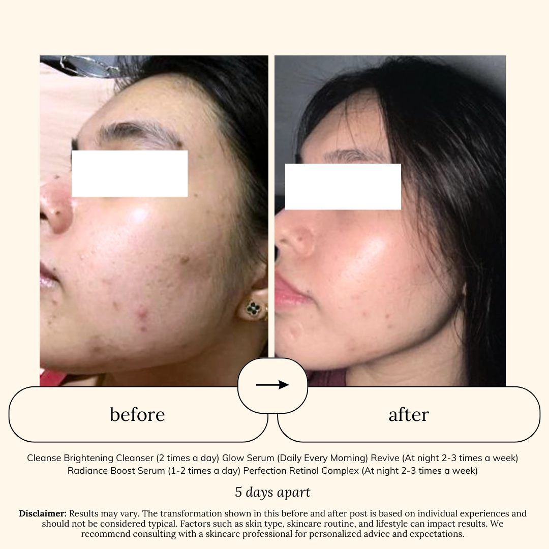 Soul Apothecary Bestseller Sets | Barrier Repair for Sensitive Skin 7 Soul Apothecary Bestseller Sets | Barrier Repair for Sensitive Skin - Image 6