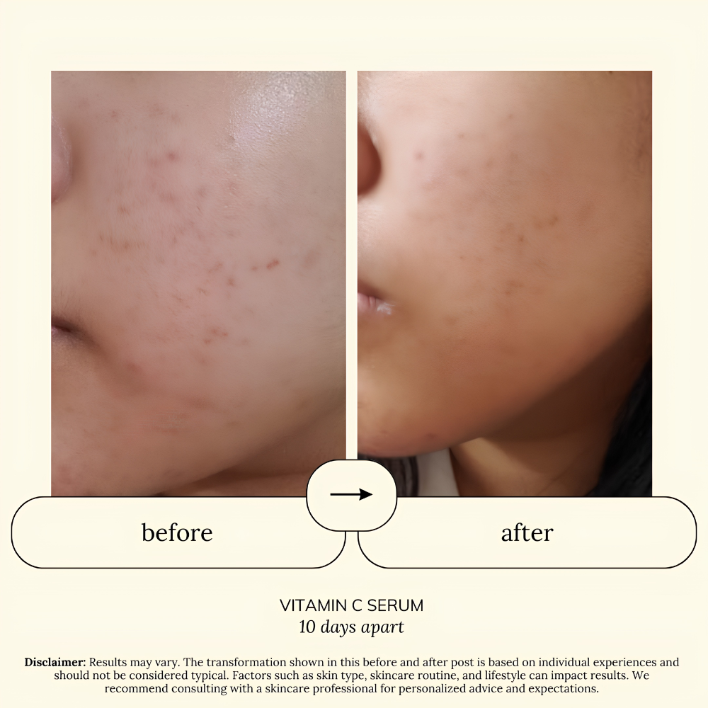 SOUL APOTHECARY | Vitamin C Brightening Serum 5 SOUL APOTHECARY | Vitamin C Brightening Serum - Image 4