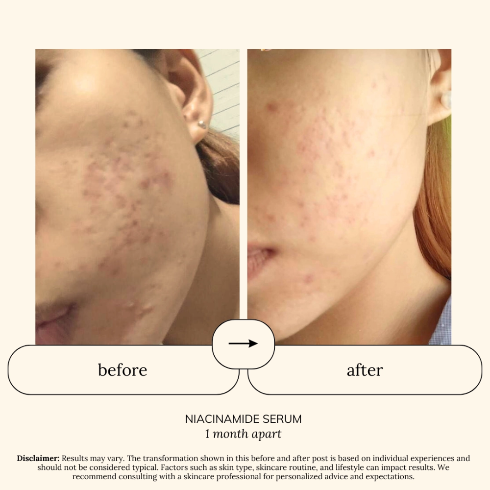 SOUL APOTHECARY | Niacinamide + HA Serum in 5% or 10% 5 SOUL APOTHECARY | Niacinamide + HA Serum in 5% or 10% - Image 4