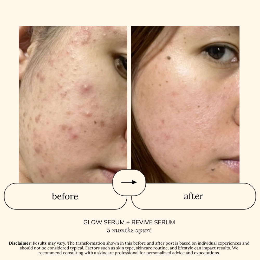 SOUL APOTHECARY | Glow Serum (Vit C + Niacinamide + Arbutin + HA + Ferulic Acid) 5 SOUL APOTHECARY | Glow Serum (Vit C + Niacinamide + Arbutin + HA + Ferulic Acid) - Image 4