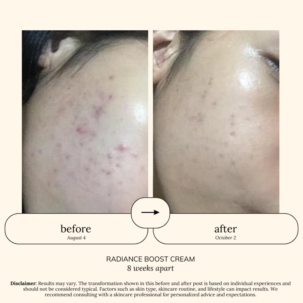 SOUL APOTHECARY: Centella CICA Cream Moisturizer 6 SOUL APOTHECARY: Centella CICA Cream Moisturizer - Image 5