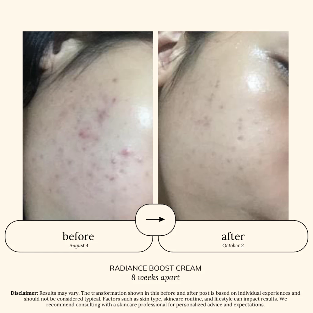 SOUL APOTHECARY | Radiance Boost Cream Moisturizer (tranexamic + α-arbutin + niacinamide + more) 4 SOUL APOTHECARY | Radiance Boost Cream Moisturizer (tranexamic + α-arbutin + niacinamide + more) - Image 3