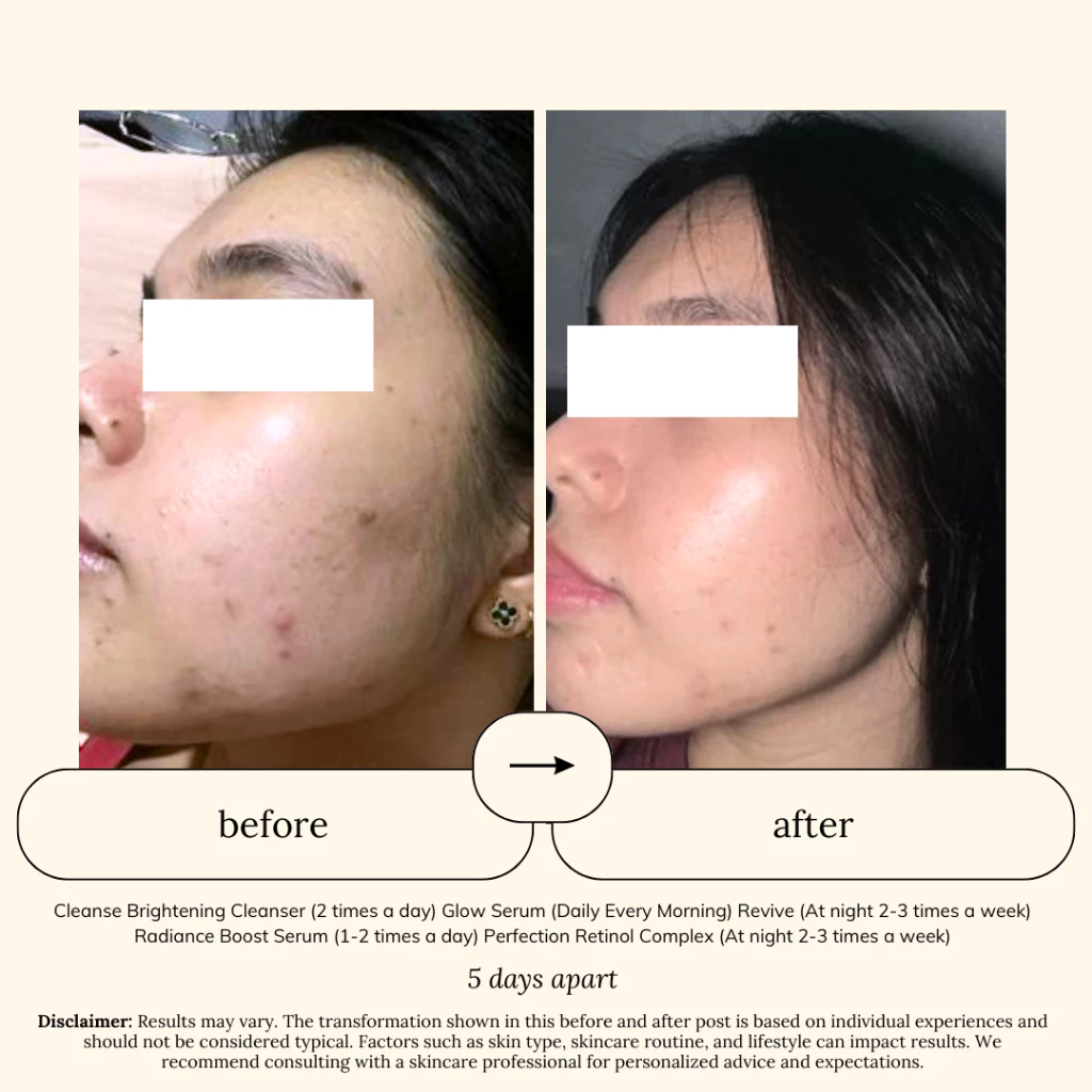 SOUL APOTHECARY | Bestseller Sets for Melasma, Hyperpigmentation, Anti-Aging 5 SOUL APOTHECARY | Bestseller Sets for Melasma, Hyperpigmentation, Anti-Aging - Image 4